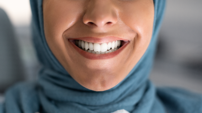 Woman with whitened Teeth