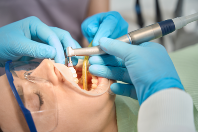 Dental Hygienists performing Teeth Polishing