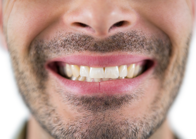 Coffee Teeth Stains: Top Dental Tips for a Brighter Smile