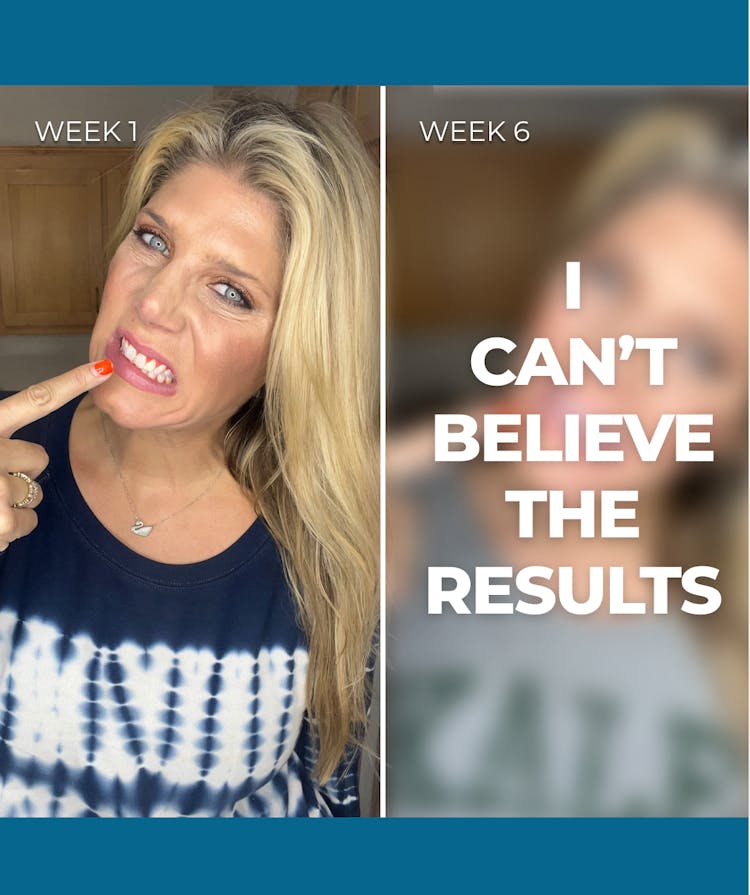 PrimeDenta | Image | 7 Reason | Women - Week Result